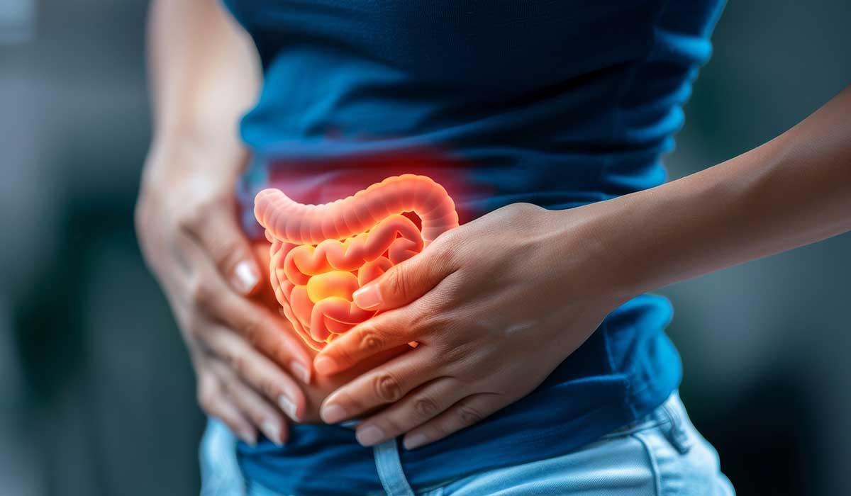 Ülseratif Kolit Beslenme Danışmanlığı