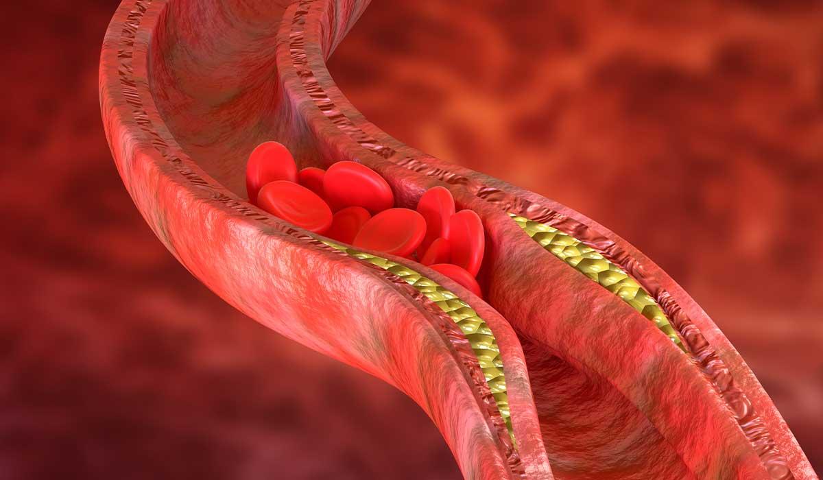 Kolesterol Dengesi İçin Beslenme Danışmanlığı